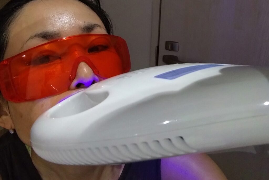 歯のホワイトニングマシン